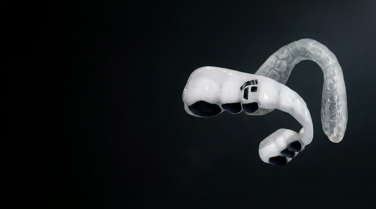 Custom-Fit vs. Boil-and-Bite Mouthguards