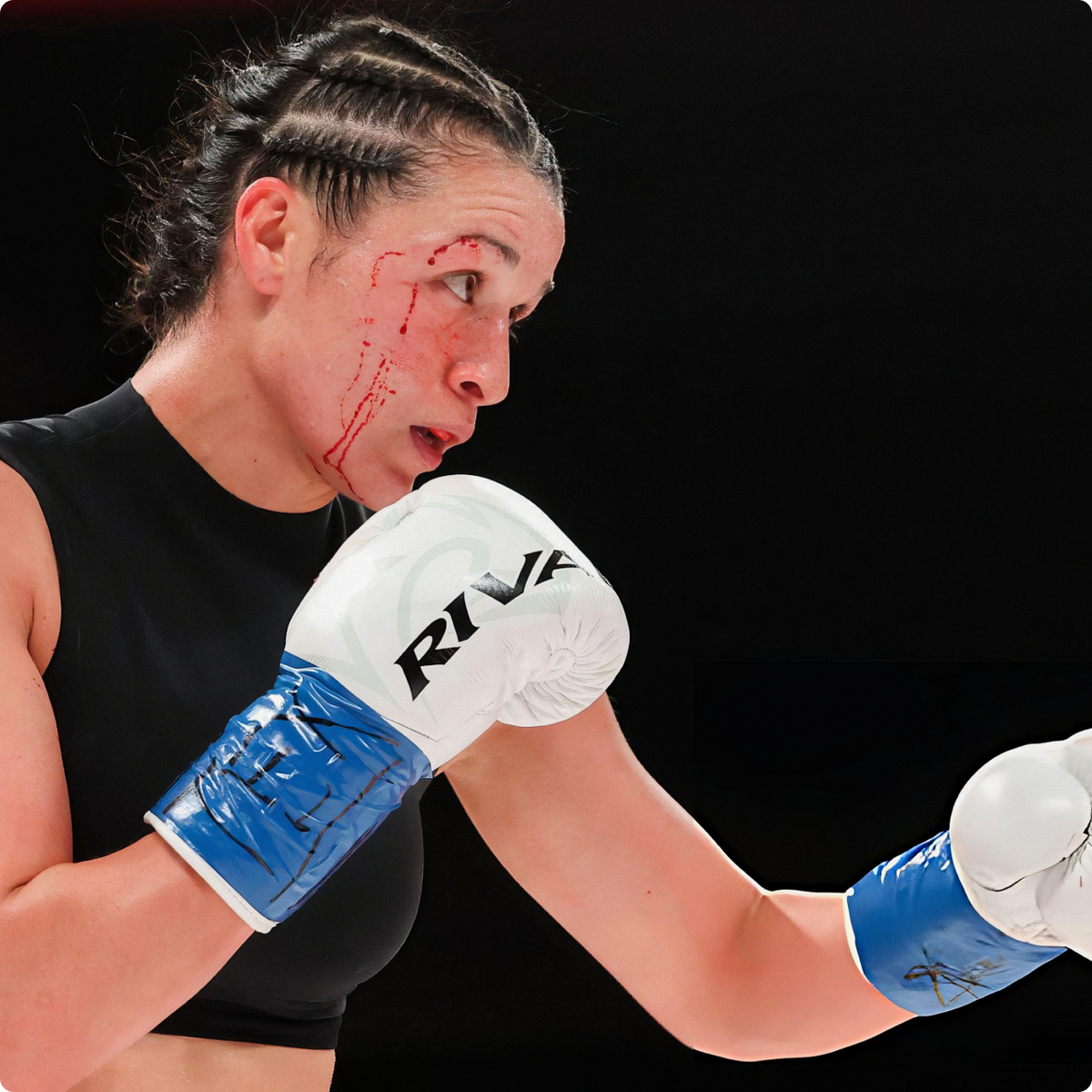 Boxing athlete with a TRUFIT mouthguard